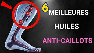 6 Meilleures Huiles Pour Dissoudre Naturellement Les Caillots Sanguins [upl. by Hayarahs]