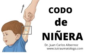 El codo de niñera cododeniñera nurseelbow shorts [upl. by Aiceila]