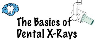 How to Read Dental XRays [upl. by Maleki]