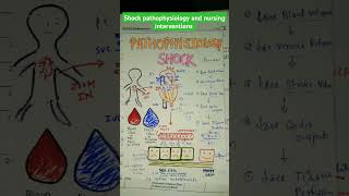 shock pathophysiology and nursing interventionsnursingnotesnursinglecturebscnurshing [upl. by Lal]