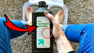 13 Surprising Uses of Hydrogen Peroxide 💥 WATCH WHAT HAPPENS [upl. by Anad]