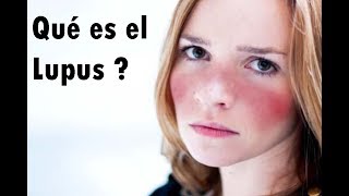 Qué es el Lupus [upl. by Hall]