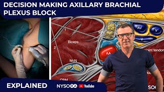 Axillary Block Decision Making Explained  Crash course with Dr Hadzic [upl. by Daune]