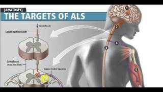 MEDICINE LECTURES  Neurology  AMYOTROPHIC LATERAL SCLEROSIS [upl. by Aihtennek]