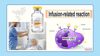 infusion related reaction [upl. by Zenger]