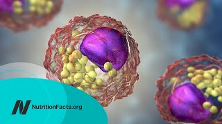 How Low Should You Go for Ideal LDL Cholesterol [upl. by Nosrej]