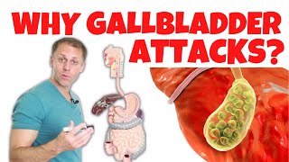 Understanding Gallbladder Attacks [upl. by Haag]