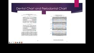 Rett Syndrome [upl. by Schnurr]