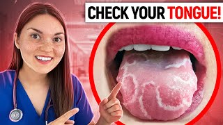 What your TONGUE says about your HEALTH Doctor Explains [upl. by Harrington]