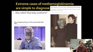 4361 Mini Lecture 11a Methemoglobinemia When Hemoglobin Turns Blue [upl. by Schoof]