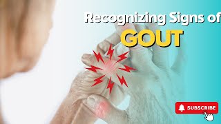 How To Recognize Signs Of GOUT And Manage Them Effectively [upl. by Cerellia]