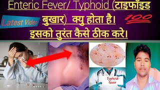 Enteric Fever Typhoid टाइफाॅइड बुखार क्यु होता है।इसको तुरंत कैसे ठीक करे। Abhia2zmedical [upl. by Elliott47]