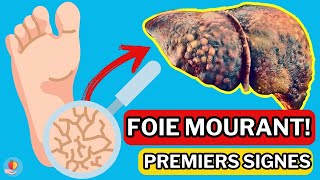 LE FOIE est en train de MOURIR 15 Signes étranges de DOMMAGES AU FOIE [upl. by Raseta934]