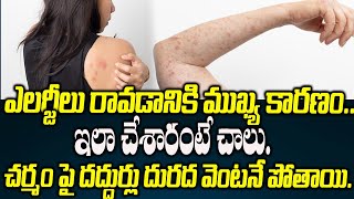 Allergy Treatment at Home in Telugu  Skin Allergy Ayurveda Treatment by Dr Upenda [upl. by Oech]