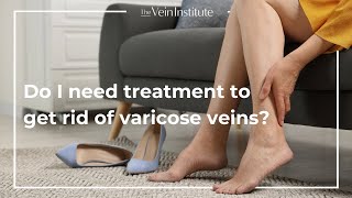 Treatment vs AtHome Care for Varicose Veins [upl. by Merrilee]