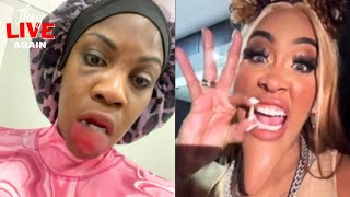 Diamond post images of her face after Baddies Reunion Tesehki Eatss Natalie has Diamonds tooth [upl. by Figge]