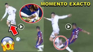 Video completo Lesión de Hobbit Bermúdez Atlante vs Dorados ESTO PASO momento exacto Hobbit Bermúdez [upl. by Richmound]