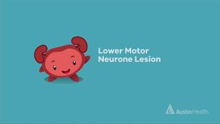 Understanding your bladder Lower motor neurone lesion flaccid bladder  animation [upl. by Michiko]