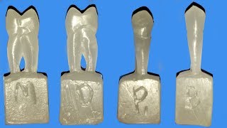 Carving of maxillary first premolar [upl. by Angelique]