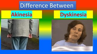 Difference between Akinesia and Dyskinesia [upl. by Reivilo988]