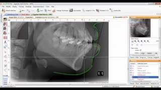 Orisceph StepbyStep [upl. by Cormack844]