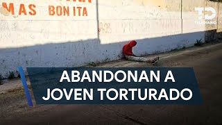 Abandonan a joven con huellas de tortura en calles de Guadalajara [upl. by Aundrea421]