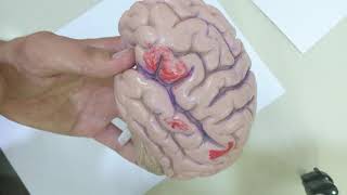 Cerebral hemisphere telencephalon part 1 practicalanatomy2297 [upl. by Eram735]