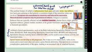 Rheumatology L5 Spondyloarthropathies p13 axial SA [upl. by Akilat]