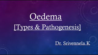 Oedema  types and pathogenesis  with examples [upl. by Biancha]