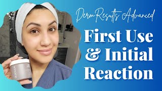 Arbonne DermResults Advanced  First Use and Reaction [upl. by Dobbins]