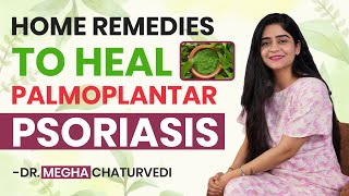 Best Home Remedies to Treat Palmoplantar Psoriasis  Palmoplantar Psoriasis Treatment [upl. by Aivad]