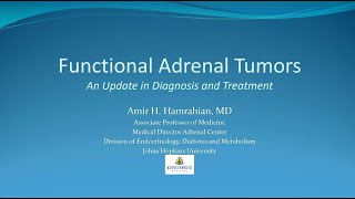 Functional Adrenal Tumors An Update in Diagnosis and Treatment [upl. by Norward479]