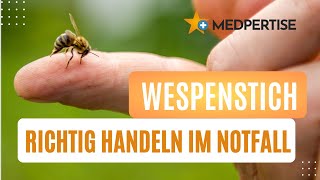 Allergie bei Wespenstich Richtig handeln im Notfall  so musst du reagieren [upl. by Carrissa]