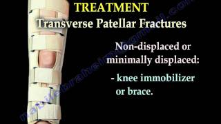 Patellar Fractures  Everything You Need To Know  Dr Nabil Ebraheim [upl. by Peale]