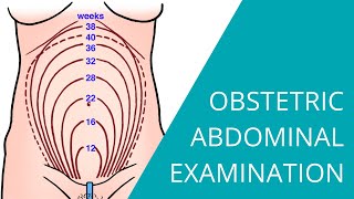 Obstetric Abdominal Examination  Steps for examining a pregnant woman [upl. by Ronna]