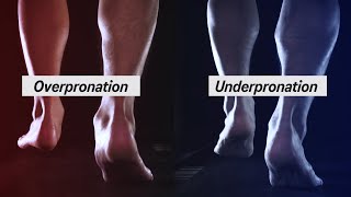 How to Determine your Pronation [upl. by Acinomal]