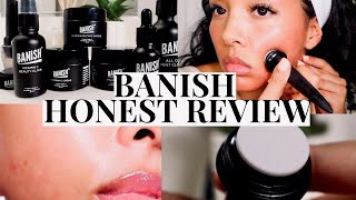 MICRONEEDLING AT HOME USING BANISHER 20 REVIEW  RESULTS 😳 [upl. by Sherlocke]