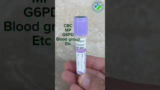 EDTA Anticoagulants  EDTA Vial  CBC Tube  Blood collection tube  EDTA vacutainer [upl. by Rehpinej608]