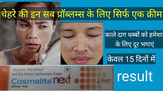 चेहरे के काले दाग धब्बों के लिए बेस्ट क्रीमcosmelite next cream review usesdosageside effects [upl. by Zilada]