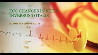 Deciphering ECG Patterns in Situs Inversus Totalis A Cardiological Analysis [upl. by Nomor886]