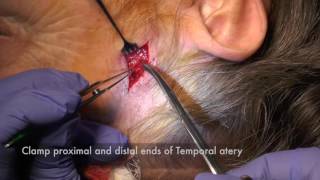 Temporal Artery Biopsy [upl. by Samp45]