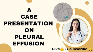 case presentation on pleural Effusion pleuraleffusion casepresentation subscribe nursingstudent [upl. by Enyrhtak]