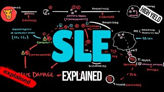 SYSTEMIC LUPUS ERYTHEMATOSUS Pathogenesis EULAR Guidlines Classification Treatment [upl. by Laniger]