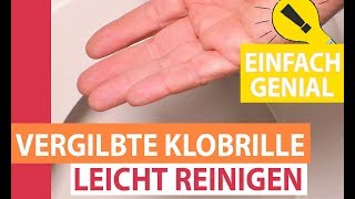 Vergilbte Klobrille leicht reinigen Toilettensitz von gelb nach weiß [upl. by Cralg937]