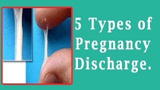 Discharge During Pregnancy  5 Types of Pregnancy Discharge [upl. by Ahsilahs197]