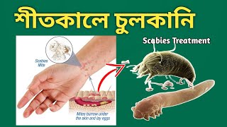 Scabies চুলকানির চিকিৎসা [upl. by Asilahs]