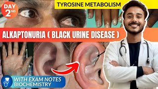 tyrosine metabolism biochemistry  alkaptonuria biochemistry  black urine disease biochemistry [upl. by Jarita]