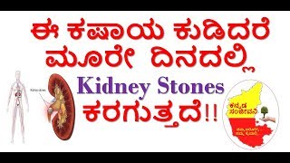 How to remove Kidney Stones Naturally at home Kannada  Kannada Sanjeevani [upl. by Lord70]