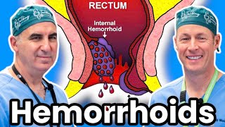 The Ultimate Treatment For Hemorrhoids [upl. by Nylodnewg]