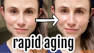 Vlog rapid skin aging amp La Roche Posay Dr Dray [upl. by Peyton210]